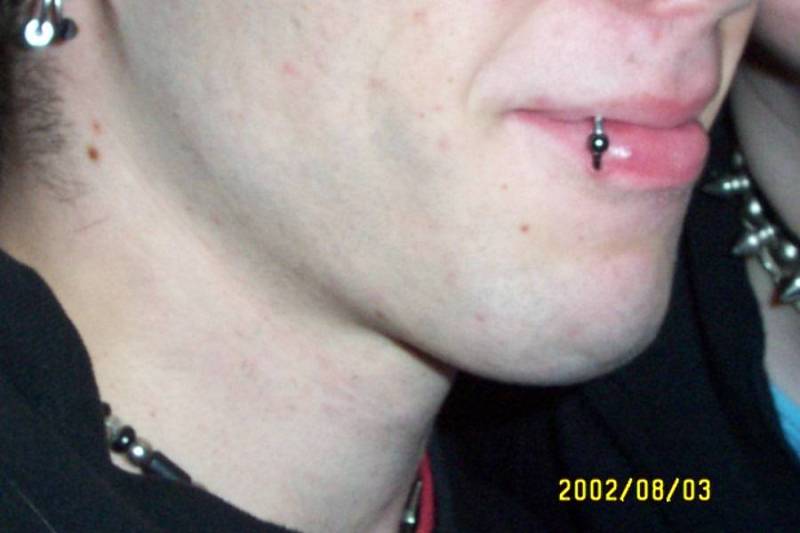 Original image